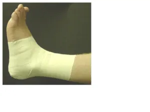 Taping Sports Injuries